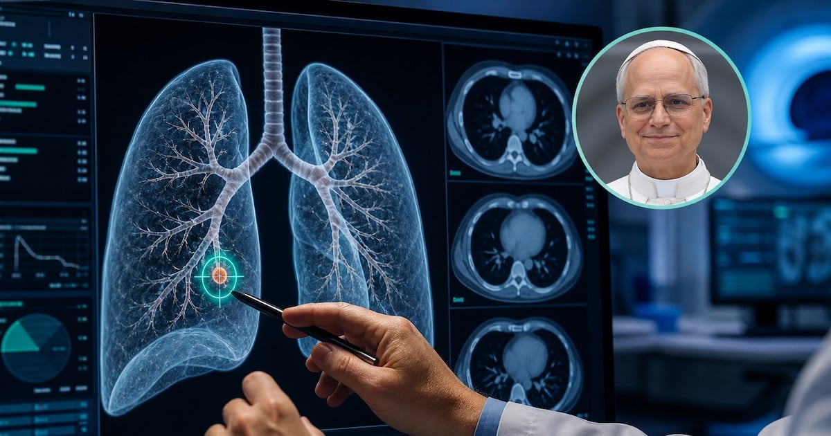 Nódulo pulmonar de tres milímetros: por qué los médicos recomiendan operarlo antes de que crezca