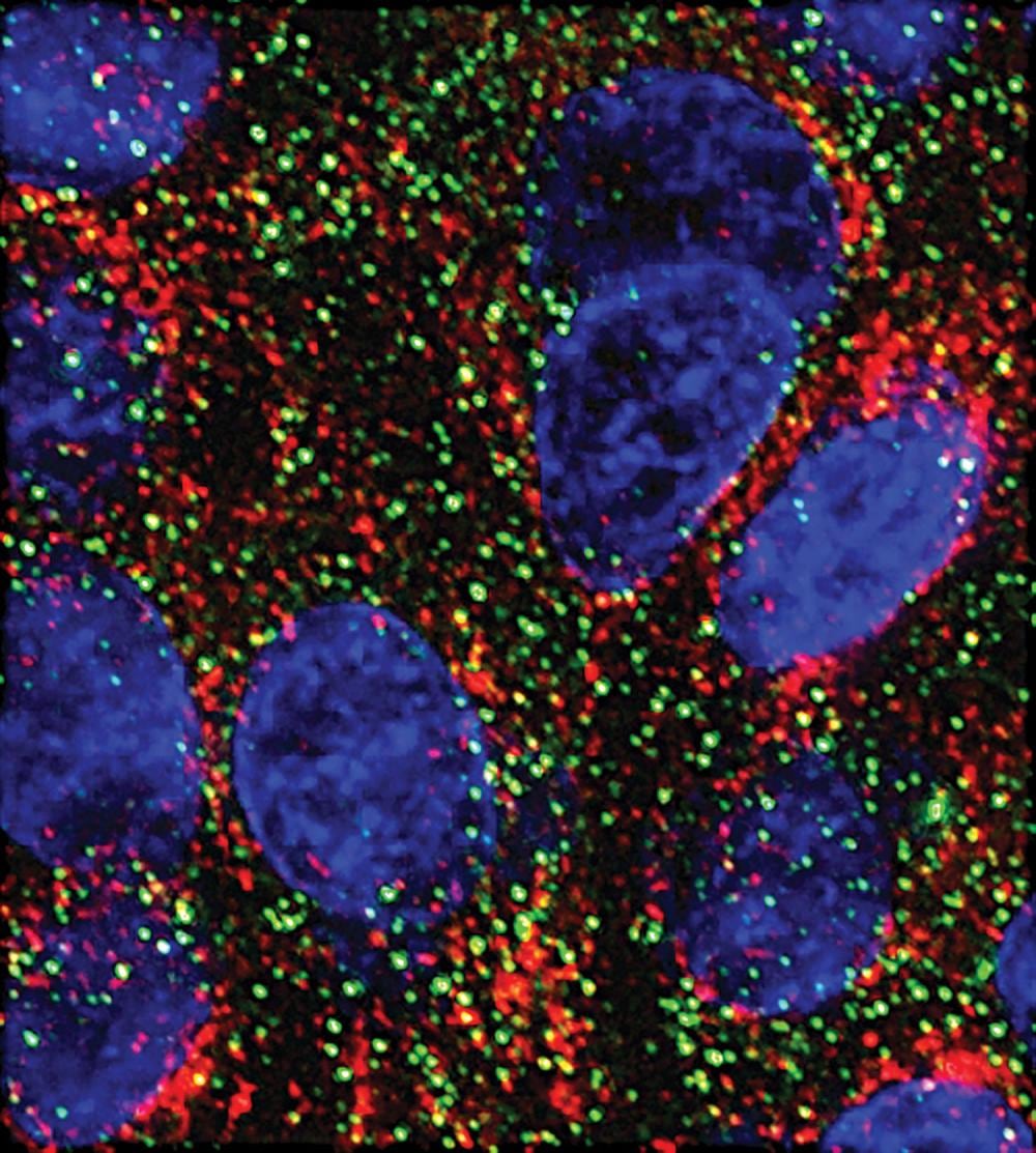 Dos microARN reducen el crecimiento de células pancreáticas en un estudio de laboratorio